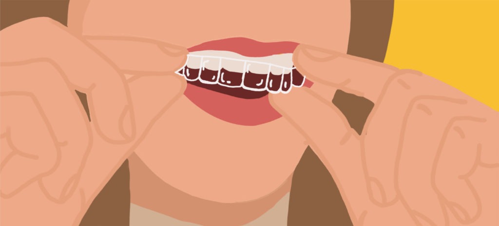 graphic showing straightening teeth