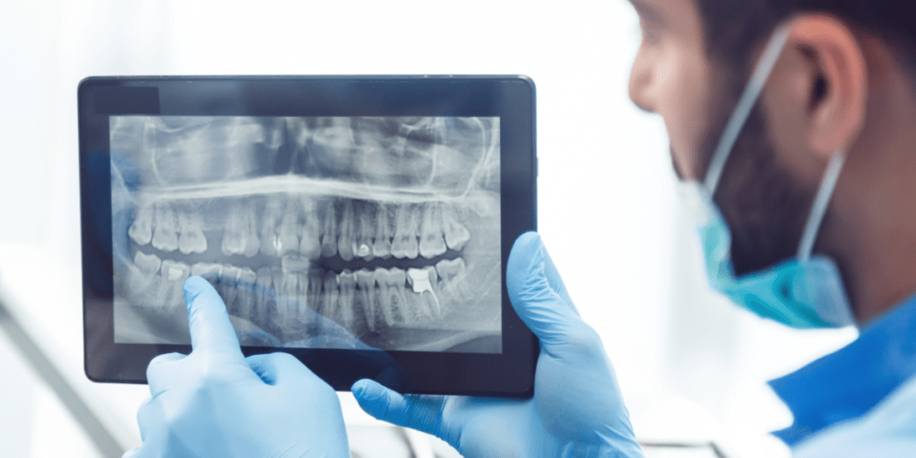 dentist showing teeth x-ray on tablet